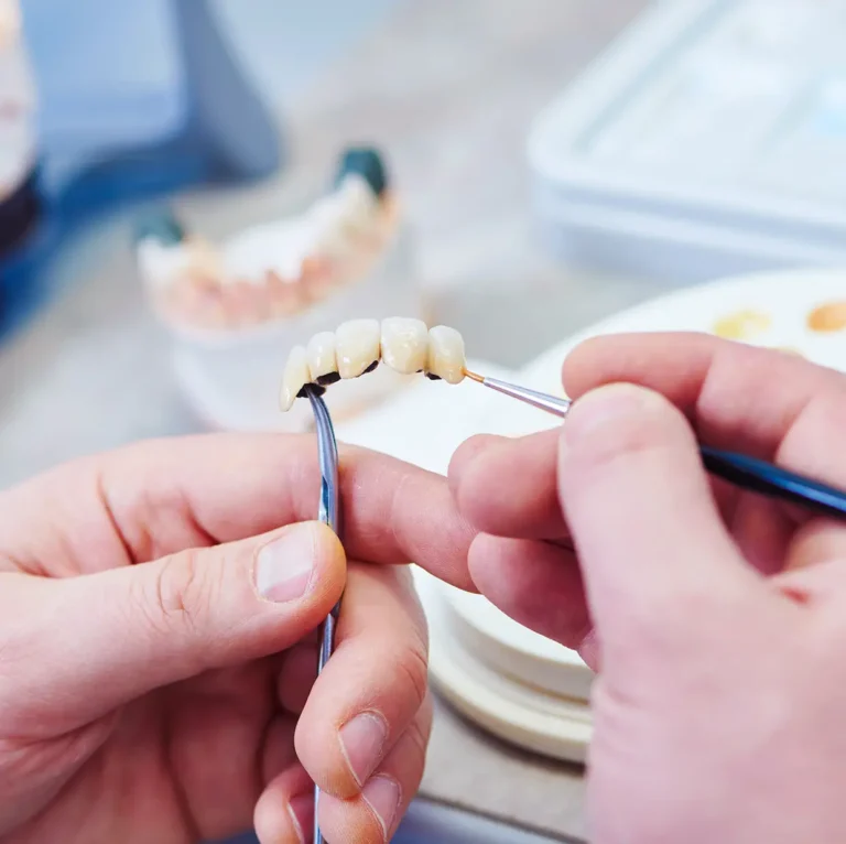 What Is Advanced Restorative Dentistry? A Complete Guide