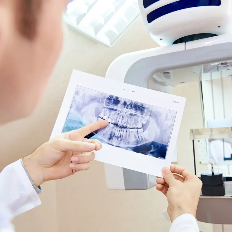 How to Choose the Best Cosmetic Dentist Near You in San Diego